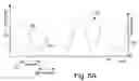 Fig. 13 - Subcutaneous cardiac rhythm management with disordered breathing detection and treatment