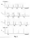 Fig. 03 - Cochlear implant sound processing method and system