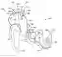 Fig. 01 - Using a genetic algorithm to fit a cochlear implant system to a patient