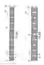 Fig. 40 - Endoprosthesis having foot extensions
