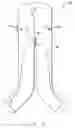 Fig. 03 - Endovascular graft with pressor and attachment methods