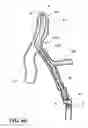 Fig. 13 - Temporary absorbable venous occlusive stent and superficial vein treatment method