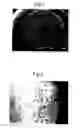 Fig. 02 - Scaffold for tissue engineering, artificial blood vessel, cuff, and biological implant covering member