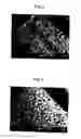 Fig. 03 - Scaffold for tissue engineering, artificial blood vessel, cuff, and biological implant covering member