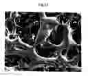 Fig. 08 - Scaffold for tissue engineering, artificial blood vessel, cuff, and biological implant covering member