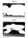 Fig. 12 - Scaffold for tissue engineering, artificial blood vessel, cuff, and biological implant covering member