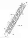 Fig. 06 - Apparatus and methods for controlled substance delivery from implanted prostheses