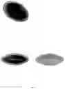 Fig. 05 - Accommodative intraocular lens and method of implantation