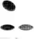 Fig. 08 - Accommodative intraocular lens and method of implantation