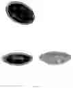 Fig. 10 - Accommodative intraocular lens and method of implantation