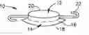 Fig. 01 - Sharp angle intraocular lens optic