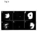 Fig. 07 - Dermal substitute consisting of amnion and biodegradable polymer, the preparation method and the use thereof