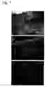Fig. 08 - Dermal substitute consisting of amnion and biodegradable polymer, the preparation method and the use thereof