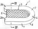 Fig. 01 - Implant for spine and method for manufacturing same