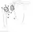 Fig. 01 - Modular humeral head resurfacing system