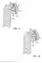 Fig. 05 - Modular humeral head resurfacing system