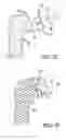 Fig. 10 - Modular humeral head resurfacing system