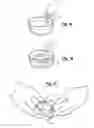 Fig. 06 - Total knee joint mold and methods