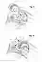 Fig. 08 - Total knee joint mold and methods