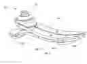Fig. 04 - Instrumented prosthetic foot