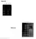 Fig. 13 - Expression of protective antigens in transgenic chloroplasts