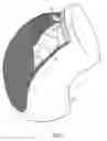 Fig. 04 - Protective appliance
