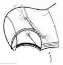 Fig. 05 - Adjustable Hood System