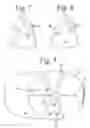 Fig. 05 - Headwear piece with selectively viewable ornamentation