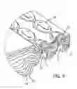 Fig. 06 - Replaceable/disposable brush head