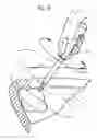 Fig. 10 - Cleaning device for cleaning pipes and receptacles