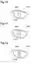 Fig. 09 - Golf club head and method of making the same