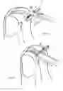 Fig. 05 - Hair trimming device