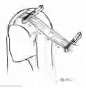 Fig. 06 - Hair trimming device