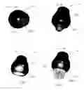 Fig. 05 - Hair dryer attachment