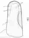 Fig. 04 - Orthotic insert and method of manufacture thereof