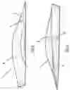 Fig. 05 - Orthotic insert and method of manufacture thereof