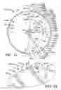 Fig. 08 - Variable tooth saw blade