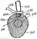 Fig. 01 - Automatic compression release mechanism including feature to prevent unintentional disablement during engine shutdown