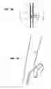 Fig. 04 - Cooking stove including invertible support rack, support rack with dual cooking surfaces, and methods of using same