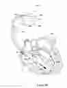 Fig. 09 - Respiratory therapy control based on cardiac cycle