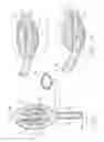 Fig. 02 - Retainer for laryngeal mask
