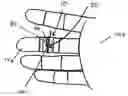 Fig. 01 - Method of flossing and flossing aid system