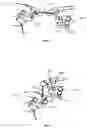 Fig. 04 - Method of flossing and flossing aid system