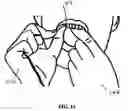 Fig. 06 - Method of flossing and flossing aid system