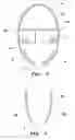 Fig. 04 - Cleaning device, cleaning tool and method of using the cleaning device