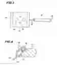 Fig. 03 - Magnetic scraper