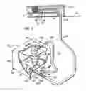 Fig. 02 - Vent cleaning system