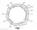 Fig. 07 - Thermal isolator for a valve and actuator assembly