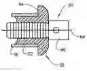 Fig. 01 - Retaining device for a tube plug