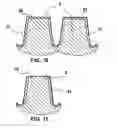 Fig. 04 - Tread having tread pattern elements formed of at least two rubber mixes